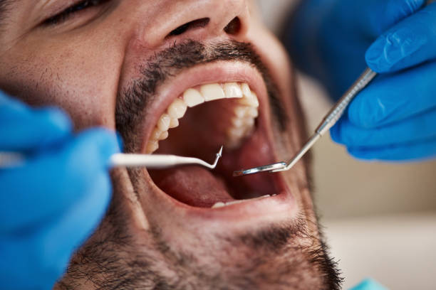 Best Pediatric Emergency Dentist in Grasonville, MD